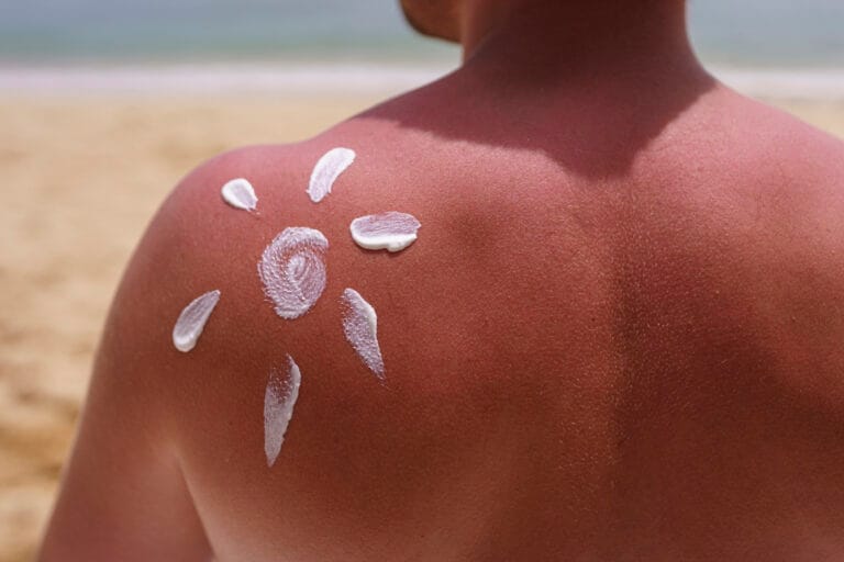 Your Complete Guide to Staying Safe and Healthy in Tenerife: From Sunburn to Emergency Rooms